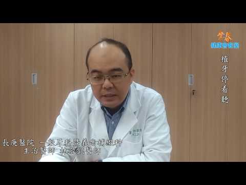 植牙停看聽