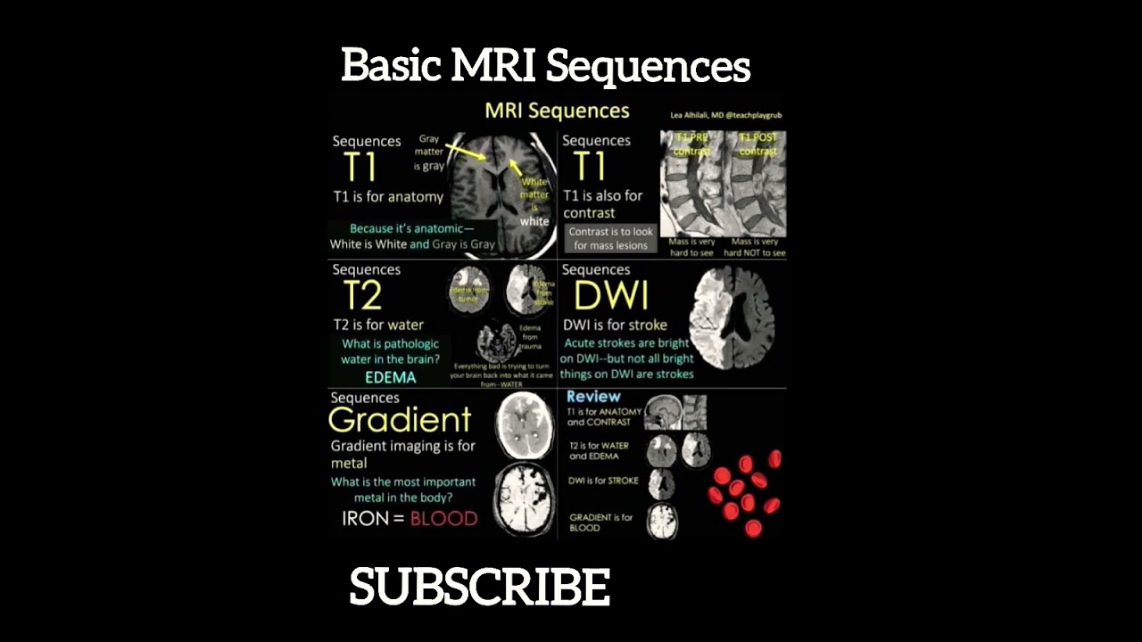 MRI BRAIN - Basic MRI Sequences #Shorts#