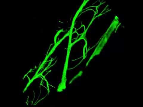 Drosophila Trachea (fly larval stem cells)