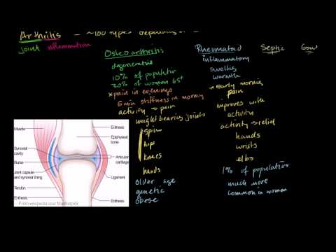 Ízületi osteochondrosis tünetei