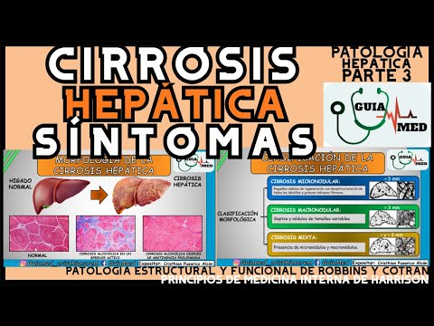 CIRROSIS HEPÁTICA SÍNTOMAS | GuiaMed