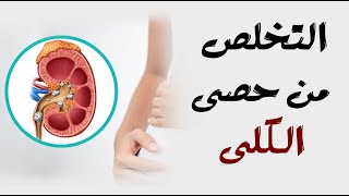 التخلص من حصى الكلى : تعرف على 7 وصفات منزلية للعلاج