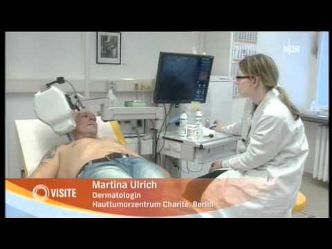Gribok eksoderil hilft nicht Der Essig gegen gribka der Beine Videos