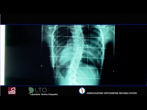 Terapia fisica dopo spalla lussazione Quanti giorni un mal di schiena, quando si estendeva