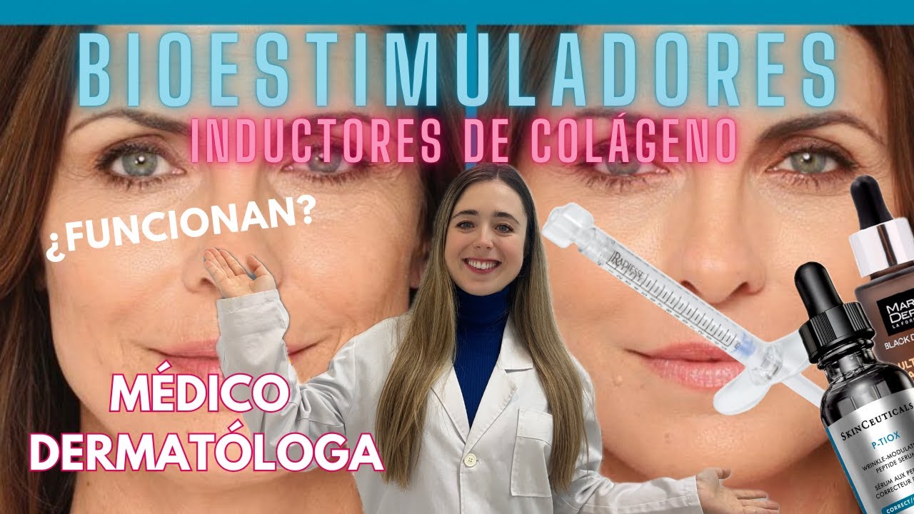 BIOSTIMULATORS OR COLLAGEN INDUCERS: DO THEY WORK? DERMATOLOGIST EXPLAINS SCULPTRA, RADIESSE...