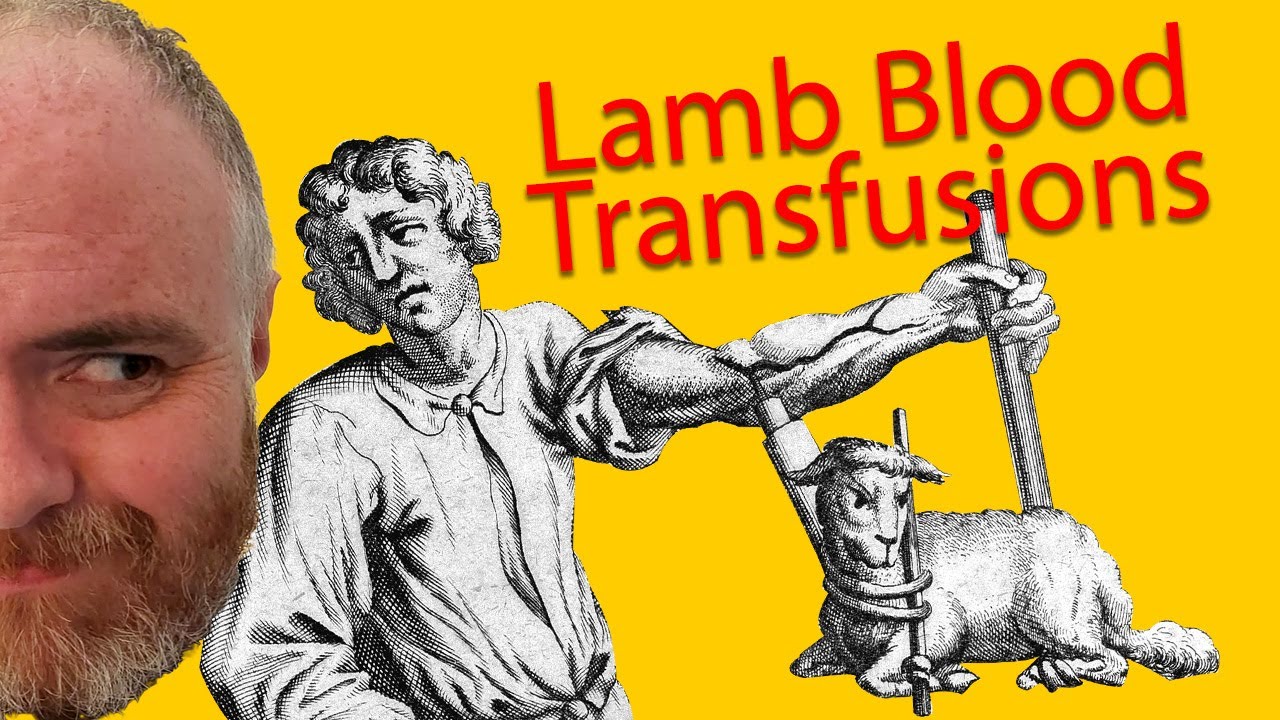 3: Transfusing lamb's blood in the 1660s