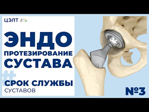 Травматология повреждение тазобедренного сустава Применение мукосата при остеохондрозе