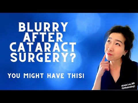 The Most Common Complication From Cataract Surgery! | Posterior Capsular Opacity & How To Treat It