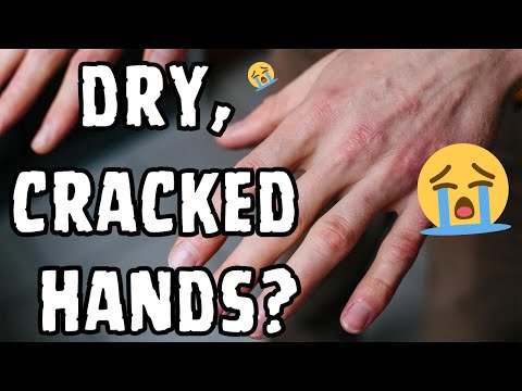 Nurse's Expert Advice for Treating Dry, Cracked Hands
