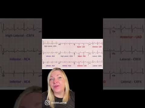#3: Leads & wall visualization of the 12 lead ECG. #criticalcarenurse