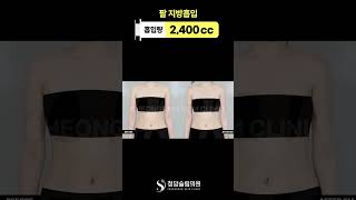 이게 직각어깨지 뭐