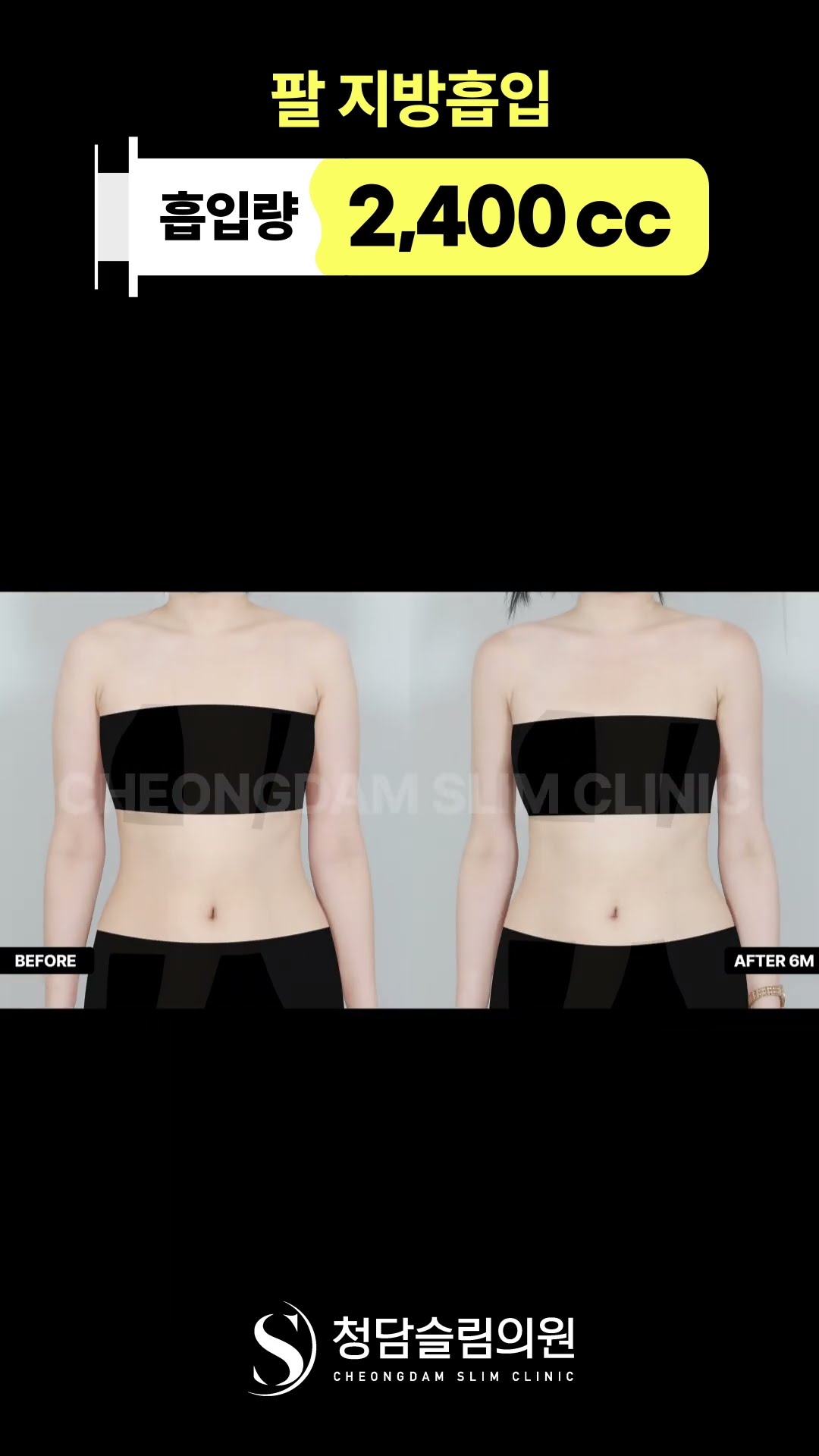 이게 직각어깨지 뭐