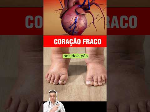 Is swelling in the feet serious?