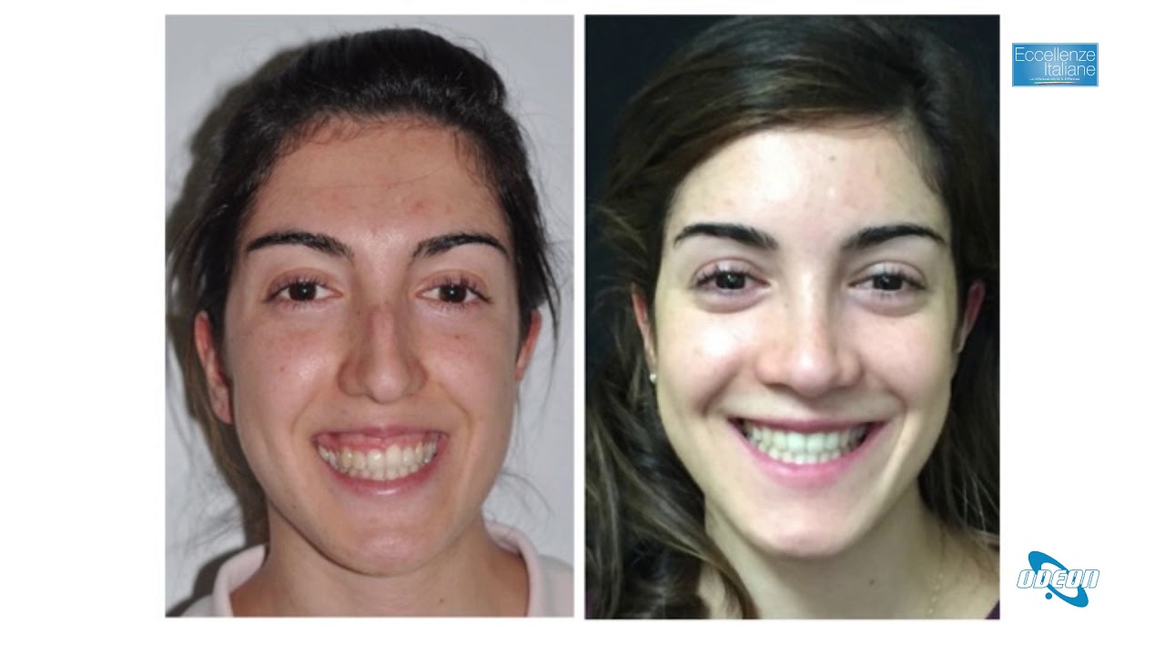 Domenico Scopelliti-21