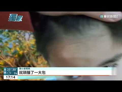 疑照明不足！　4歲童遭遊具絆倒額頭腫一包
