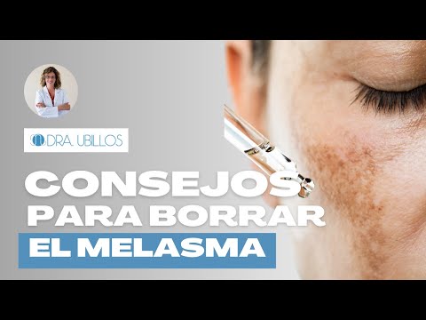 CONSEJOS PARA BORRAR EL MELASMA