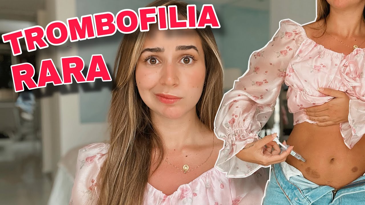 Eu tenho Trombofilia Rara - Fabiola Melo