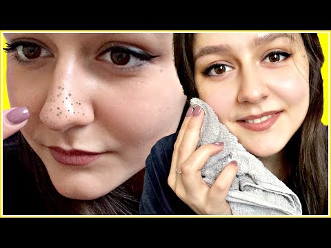I Removed My Blackheads & Whiteheads With This Simple And Effective Trick Video