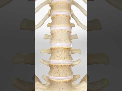 Understanding herniated disc pain (3D Animation)