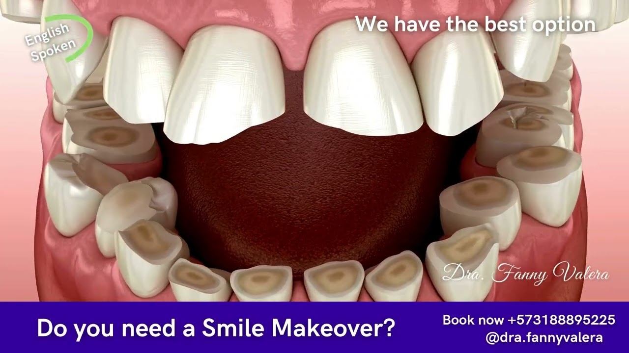 Fanny Valera Velásquez-134