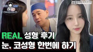 [눈성형+무보형물 코끝성형] 의느님 덕분에 변신했어요....♥ 실제환자 리얼 리뷰영상