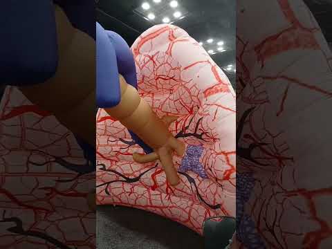 Part 8. Inside a balloon lung.
