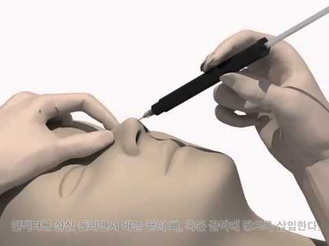 คลินิกศัลยกรรมเพื่อเพิ่มสมาชิก ดูออนไลน์เป็นหมอนวดยื่นผู้หญิง