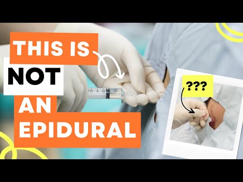 Epidural Vs Spinal Anesthesia - Understanding the difference