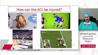 Anterior Cruciate Ligament Injury & Reconstruction An Overview - Mark Jackson, Sports Surgery Clinic
