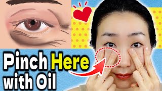 Pinch Here with Oil to Immediately Reduce Under Eye Bags & Wrinkles around Eyes (Crow Feet)