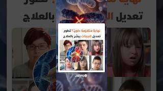 اختراق علمي يفتح الباب أمام إمكانية تعطيل كروموسوم زائد   بصيص أمل لعلاج متلازمة داون عبر تعديل thumbnail