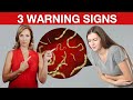 3 Early Warning Signs You Have Parasites 🐛 | Dr. Janine