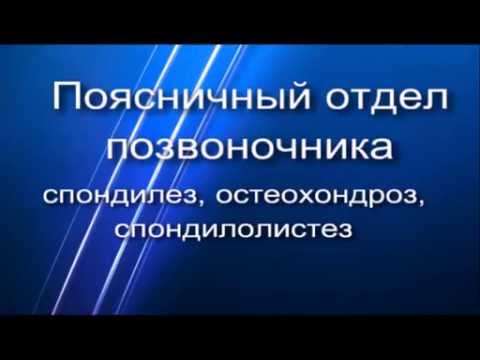 Операция на сколиоз 3-4 степени Остеохондроз в виде выпрямления физиологического лордоза