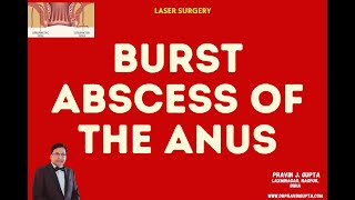 Download Lagu PERIANAL ABSCESS- IF RUPTURED, GOES FOR A FISTULA FORMATION Thumbnail