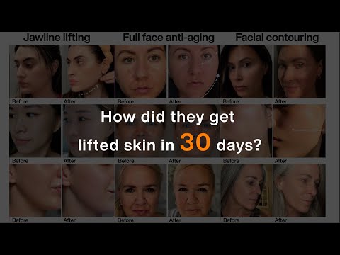 How AMIRO users achieved lifted, smooth, and radiant skin in 30 days? Here’s what they say.