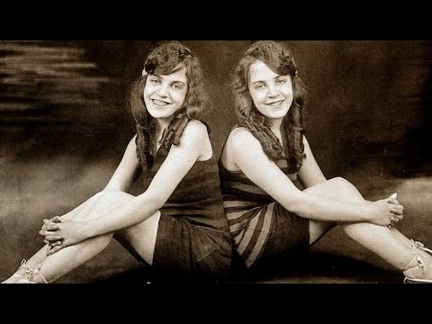 The Untold Truth Of The Conjoined Hilton Sisters