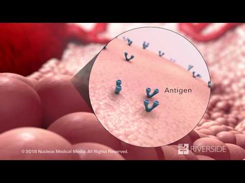 Immunotherapy: How the Immune System Fights Cancer?