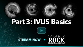 IVUS Basics, IVUS Part 3 School of Rock