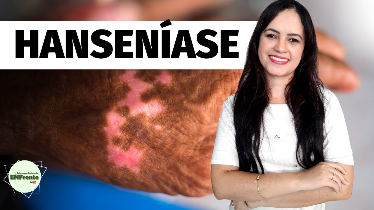 AULA | Hanseníase - Profa. Juliana Mello