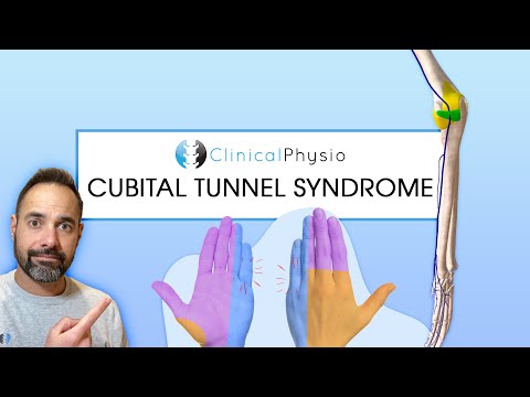 Cubital Tunnel Syndrome | Expert Physio Review on Assessment