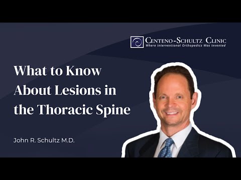 Thoracic Spine Lesions: What to Know About Lesions in the Thoracic Spine