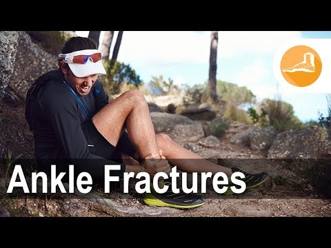 Ankle Fractures discussed by Dr. Ahmed