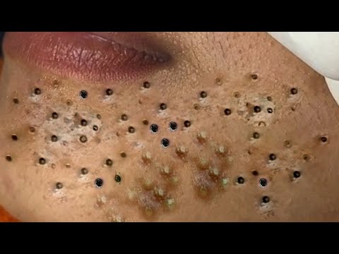 When you reach the end of your rope, tie a knot in it and hang on #215