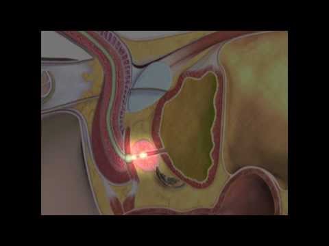 Urinary Catheterisation - Clinical Skills Series
