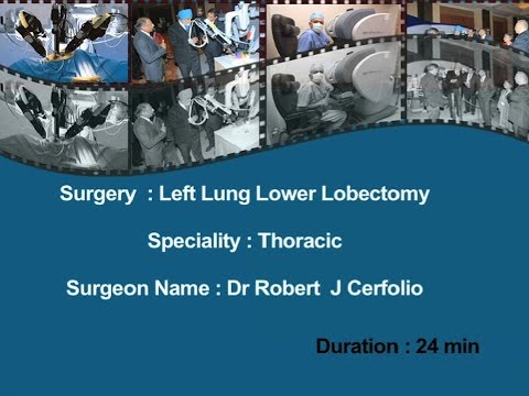 Left Lung Lower Lobectomy