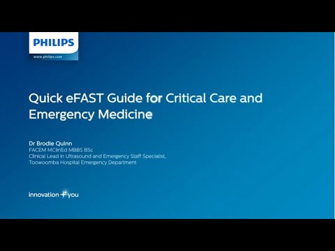 Quick eFAST guide for critical care and emergency medicine