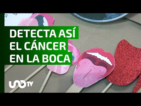 We tell you what the symptoms of oral cancer are.