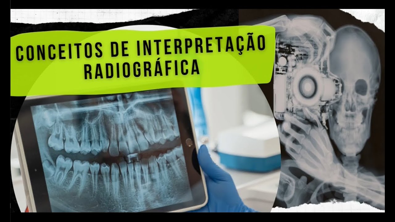 Interpretação Radiográfica (Com Diagnósticos)