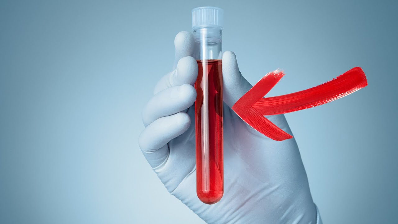 YouTube video thumbnail