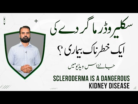 Kidney Most Dangerous Disease | Symptoms & Treatment Scleroderma in Urdu